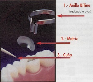 Palodent as used